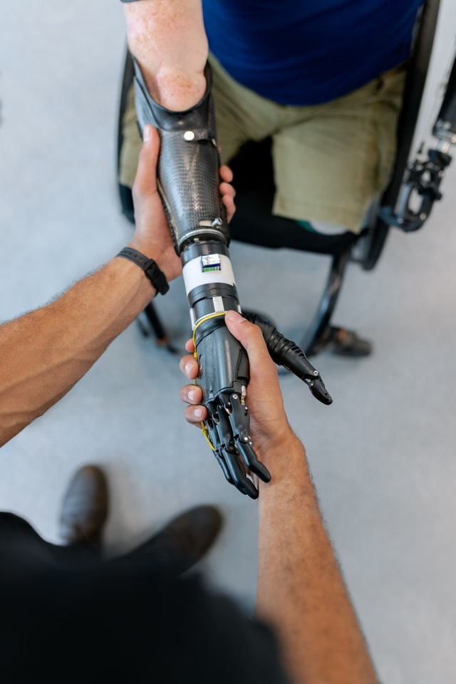 Mechanical engineer fitting a prosthetic robotic arm on a person.